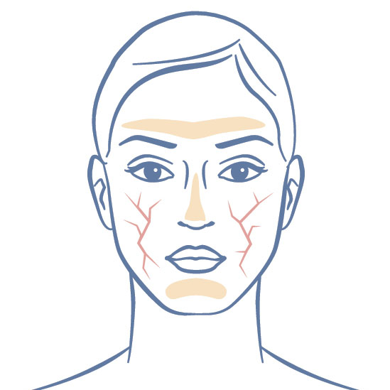 Incompatible Skin Combination Skin - iS CLINICAL